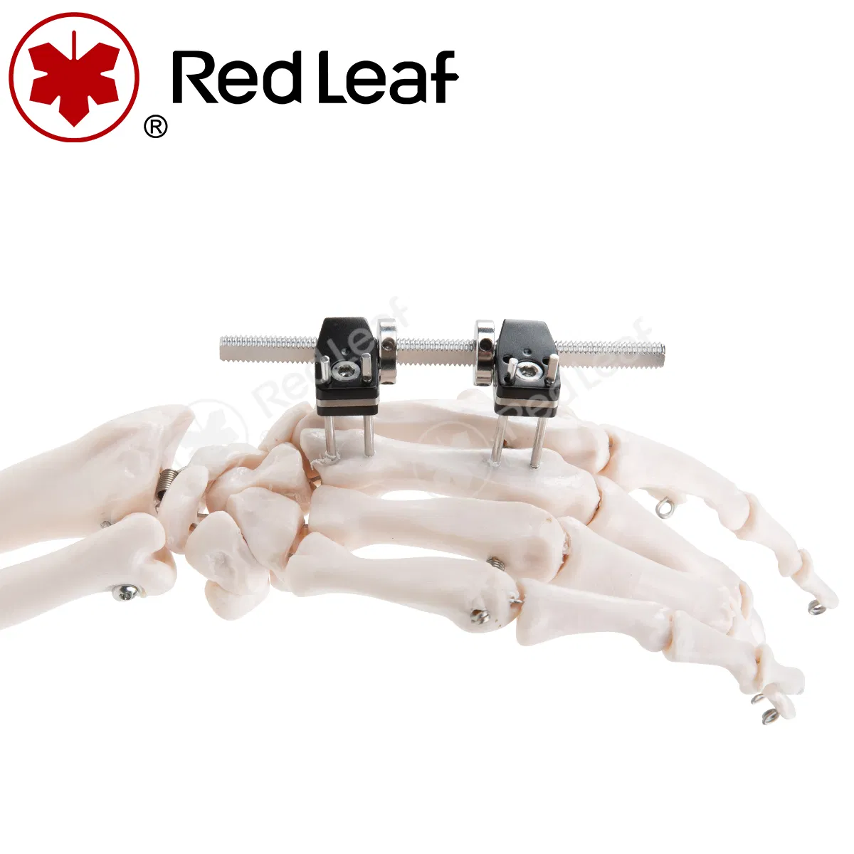 Best Price Orthopedic Surgical Instrument External Fixator for Finger Palm Fracture