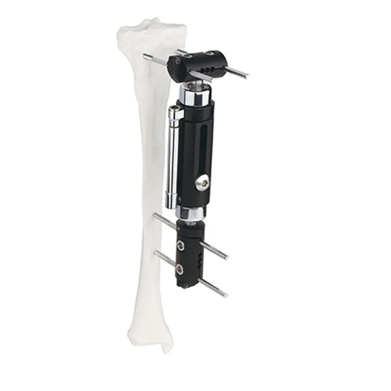 Dynamic Axial External Fixator