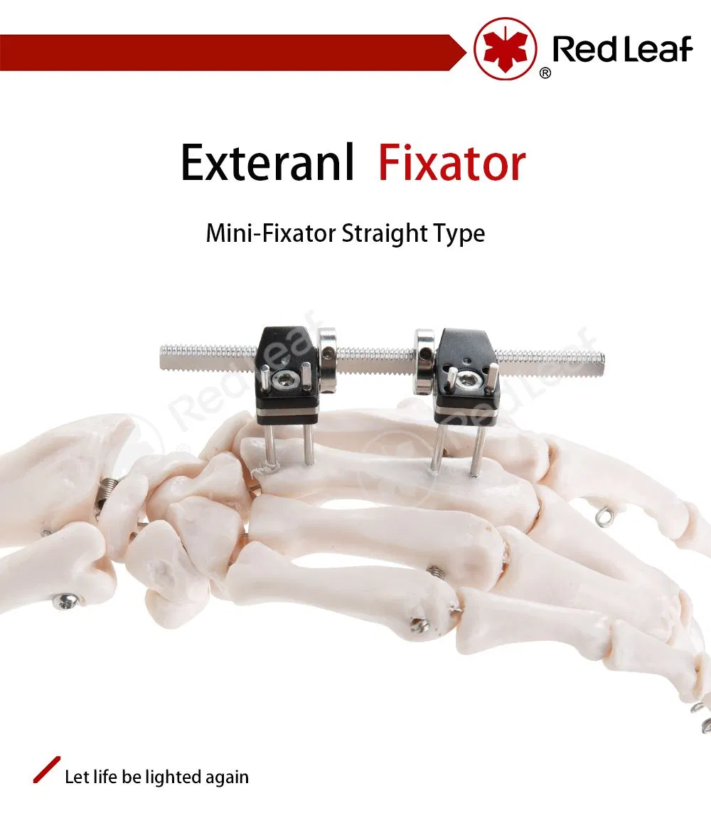 External Fixator for Finger Palm Fracture