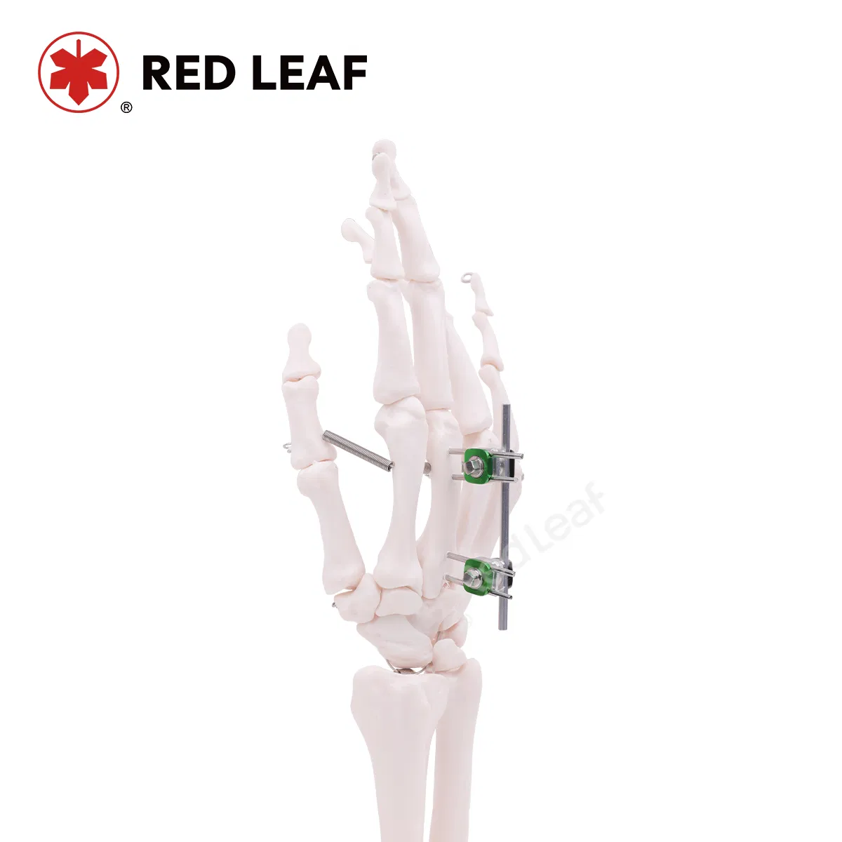 Premium Combination Finger Palm External Fixator for Orthopedic Use