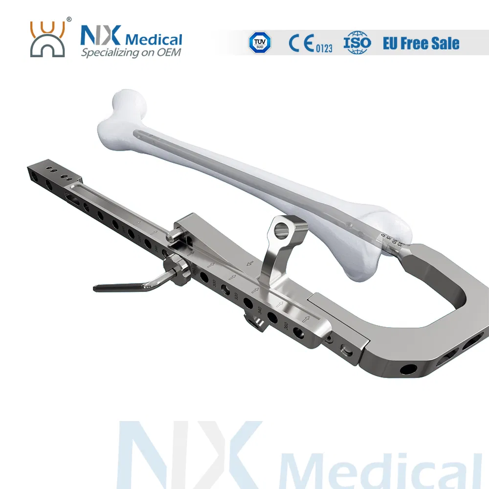 Nx Medical Retrograde Titanium Femoral Intramedullary Interlocking Nail System for Orthopedic Implants