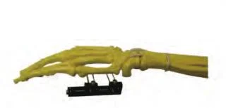 Orthopedic Surgical Mini-Horizontal Axis External Fixator