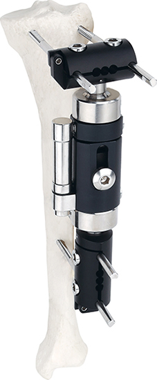 Wrist Fixator External Fixator Fatory Supply