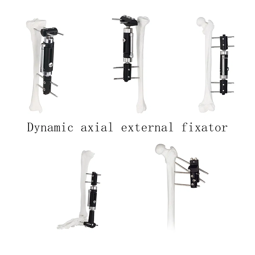 Related Orthopedic Products