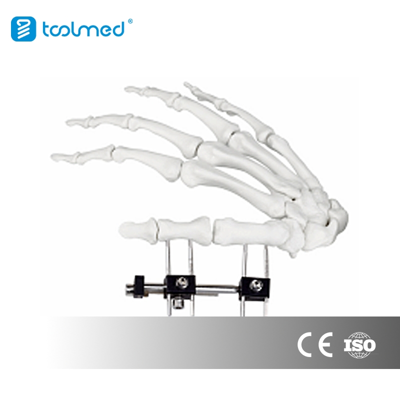 Toolmed Mini Fixator Combined Type Orthopedic External Fixator Orthopedic Device Mini Finger and Palm Fixator