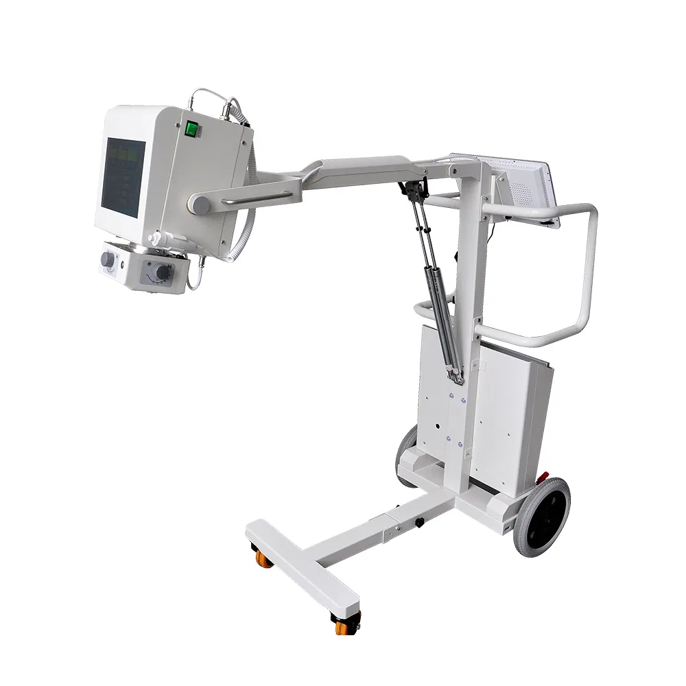 Ltx35 New Medical Trolley Portable Digital 5kw 100mA X-ray Machine