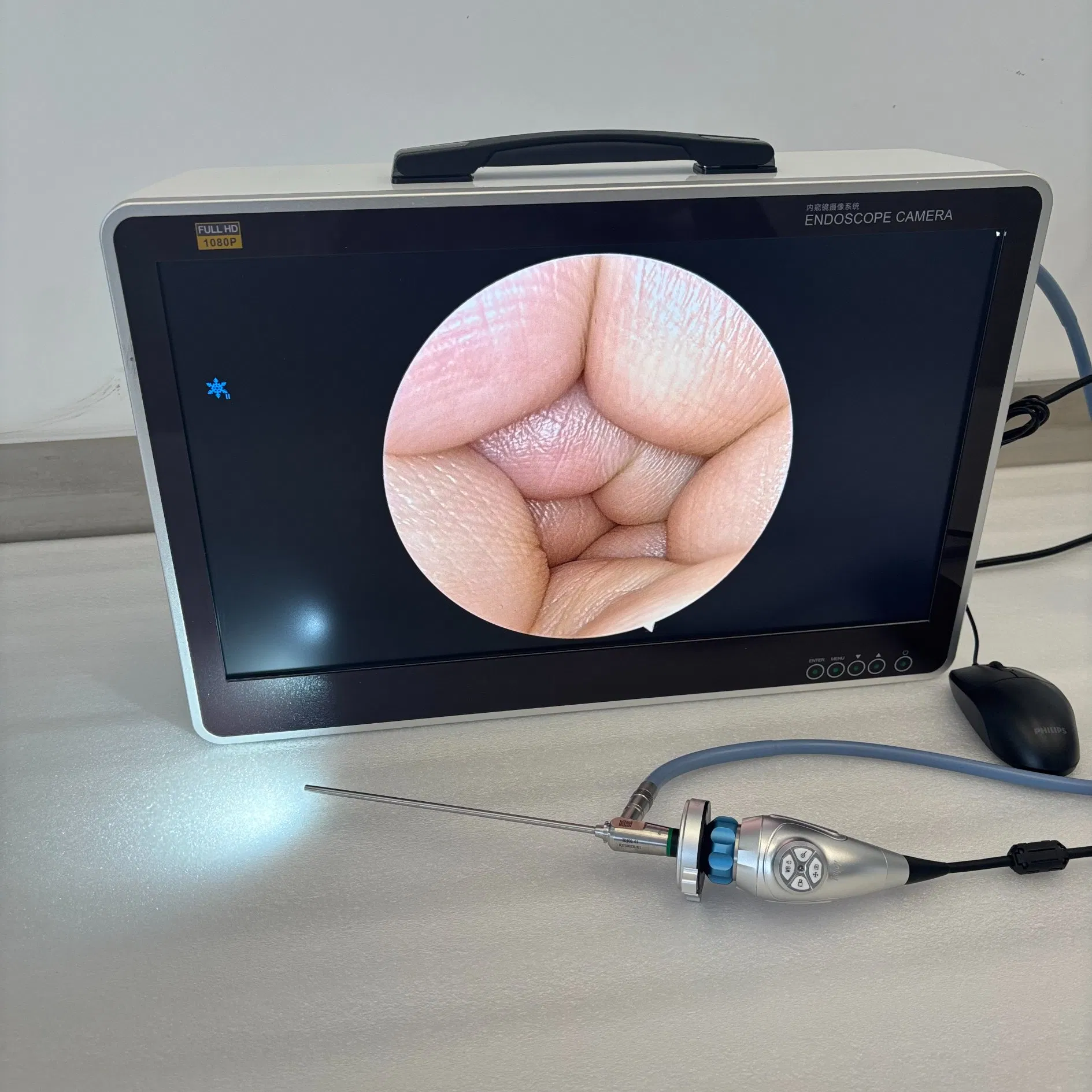 Video Camera System 24 Inch All in One Portable Full Endoscopic