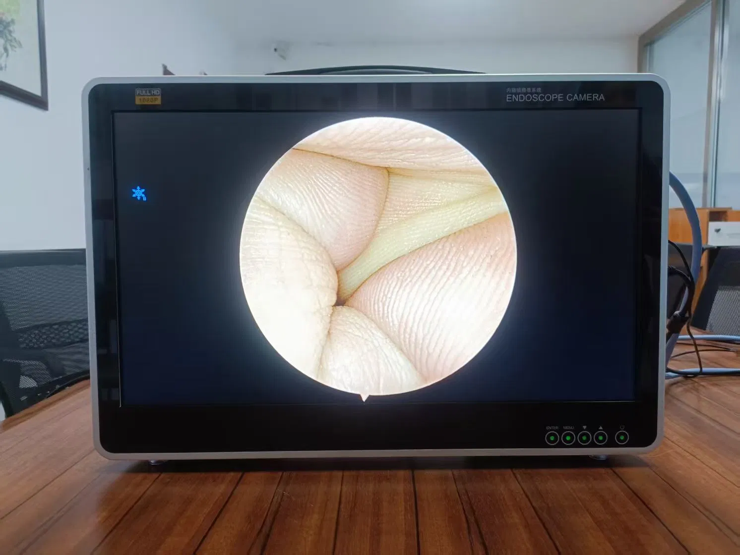 Video Camera System 24 Inch All in One Portable Full Endoscopic