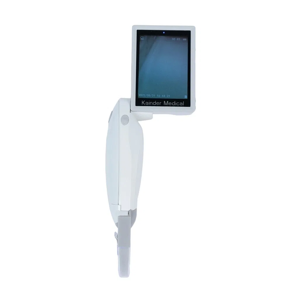 All-in-One POM-01 Lithium Battery Endoscope Video Laryngoscope for Acute Respiratory Obstruction
