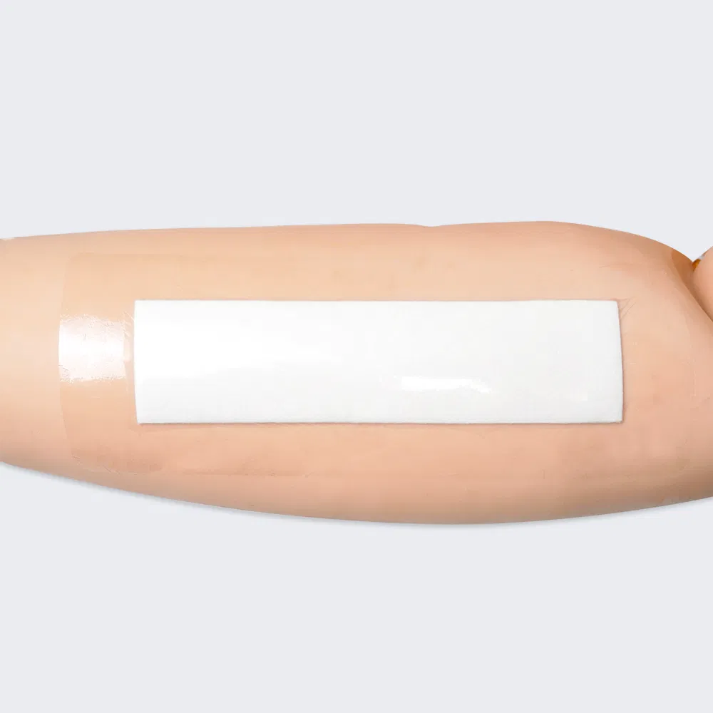 Wound Dressing Application