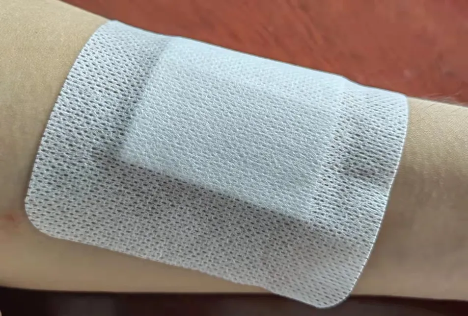 Application of Wound Dressing