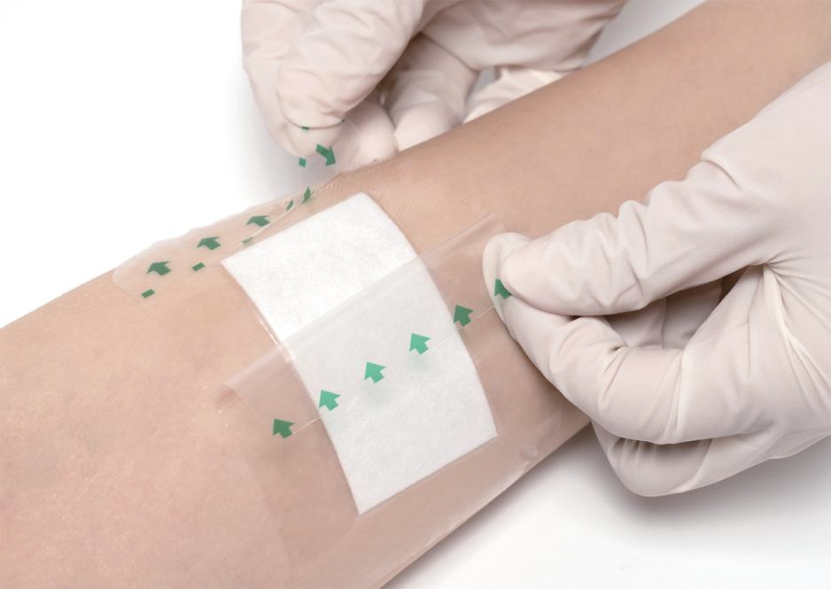 Needle Transparent Dressing Film Transfusion Dressing