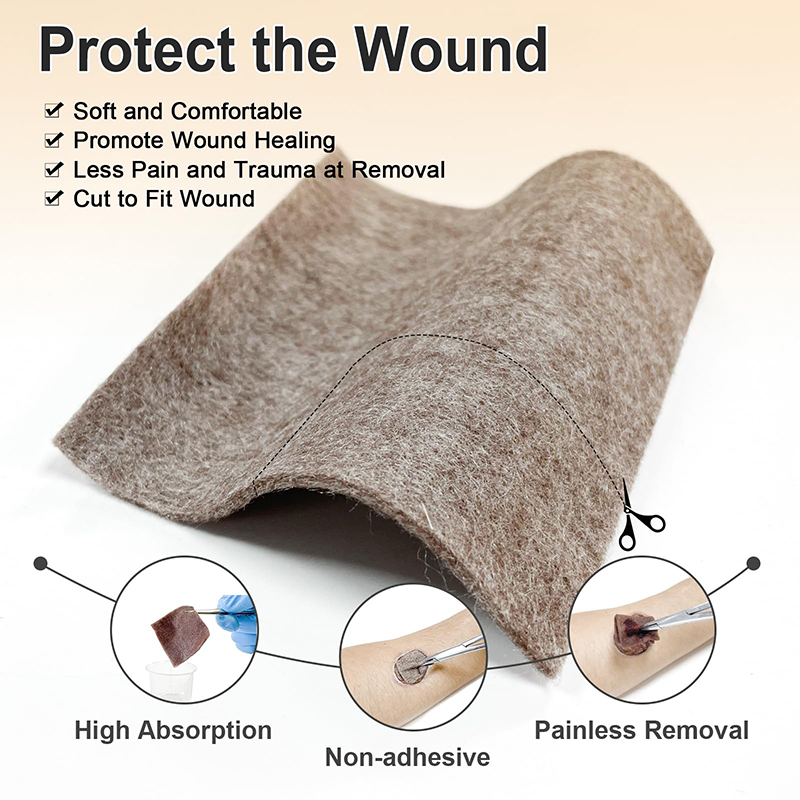 Antibacterial Silver Alginate Calcium Dressing for Wound Healing