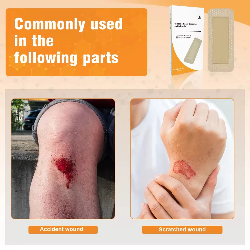 Adhesive Care Dressing