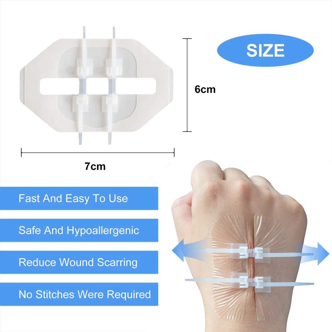 Wound Closure Details
