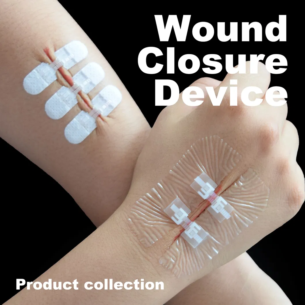 Wound Closure Device