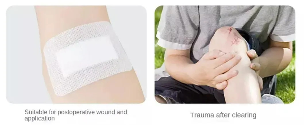 Wound Application