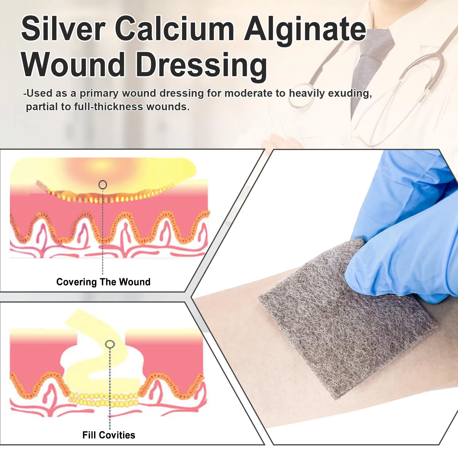 Silver Alginate Dressing 4
