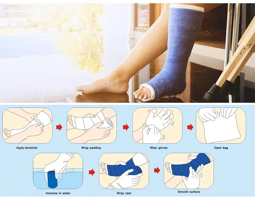 Fiberglass Casting Tape Details