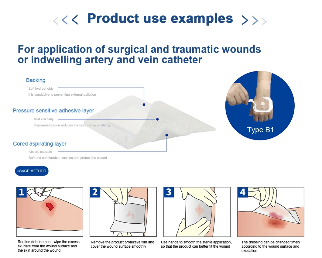 Wound Dressing Details
