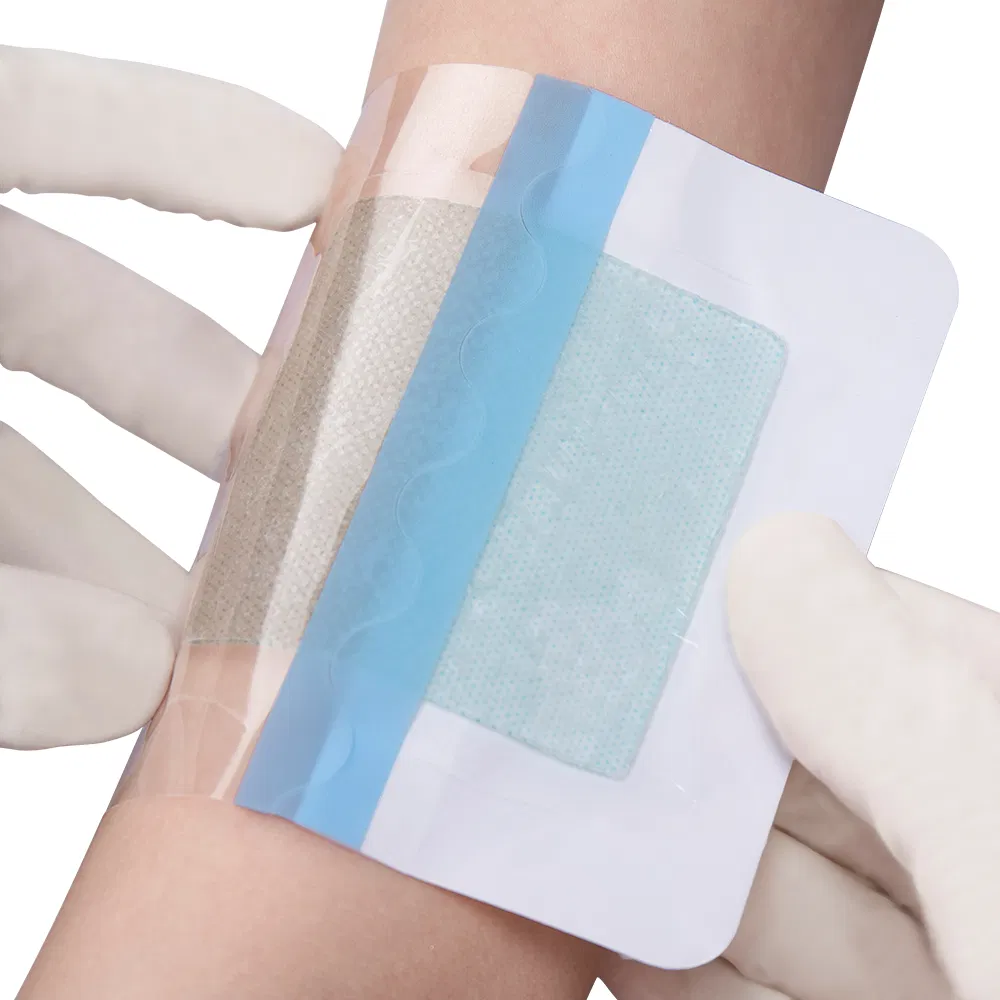 Sterile Surgical Dressing Hydrogel Burn Dressing for Wound Care