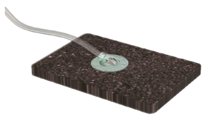 Wound Care Burn Treatment Npwt Disposable Vacuum Sealing Drainage Dressing