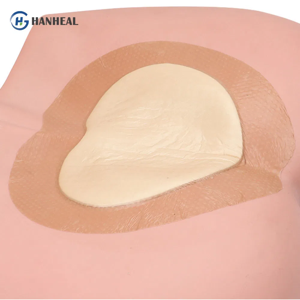 Waterproof Foam Dressing -Custom Heart-Shaped Flexible &amp; Skin-Friendly Wound Care