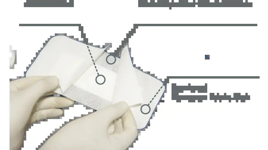 Wound Dressing Application