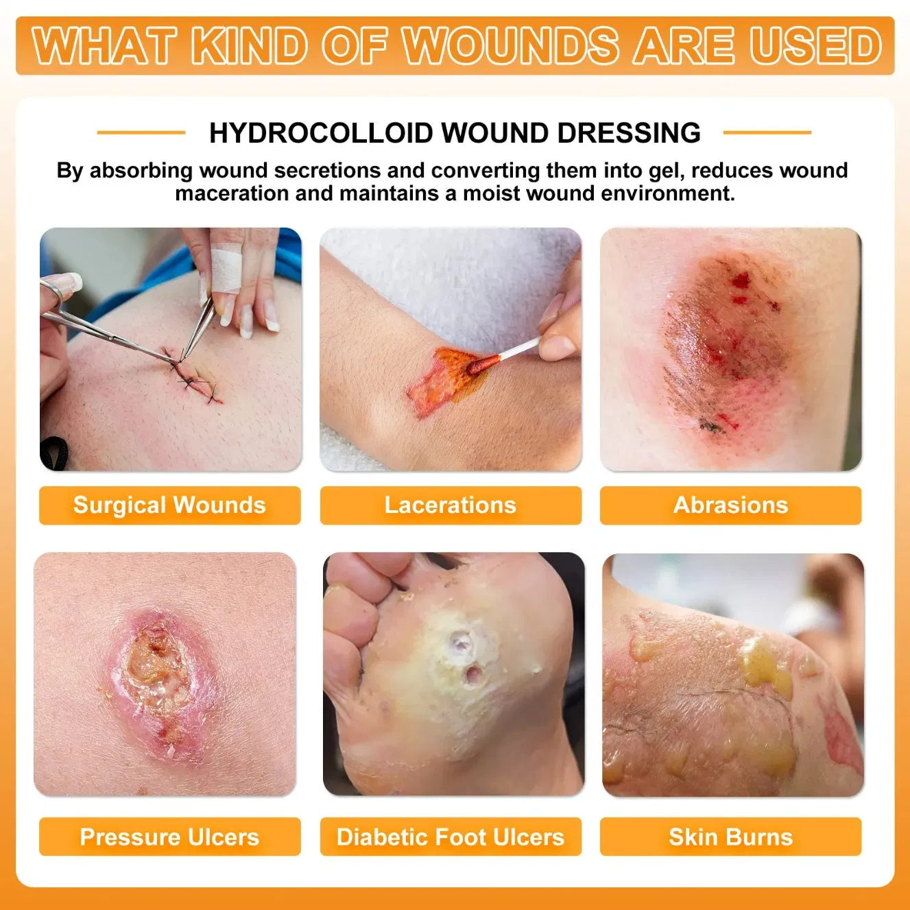 High Quality Hydrocolloid Dressing with Gel Protective Film for Medical Wound Management