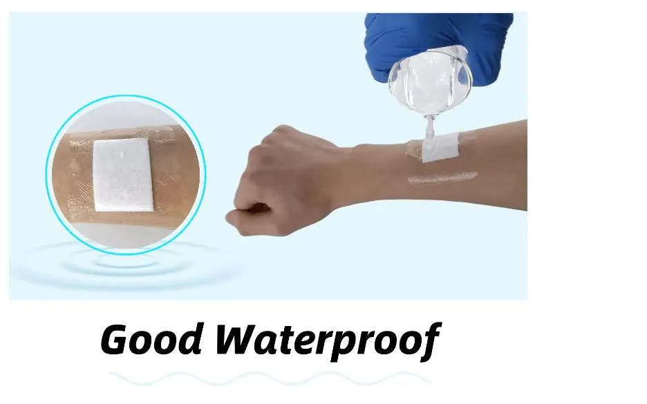 Wound Dressing Detail