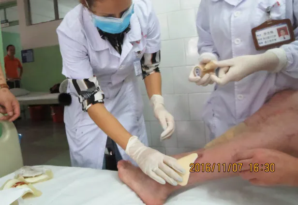 Wound Dressing Detail 3