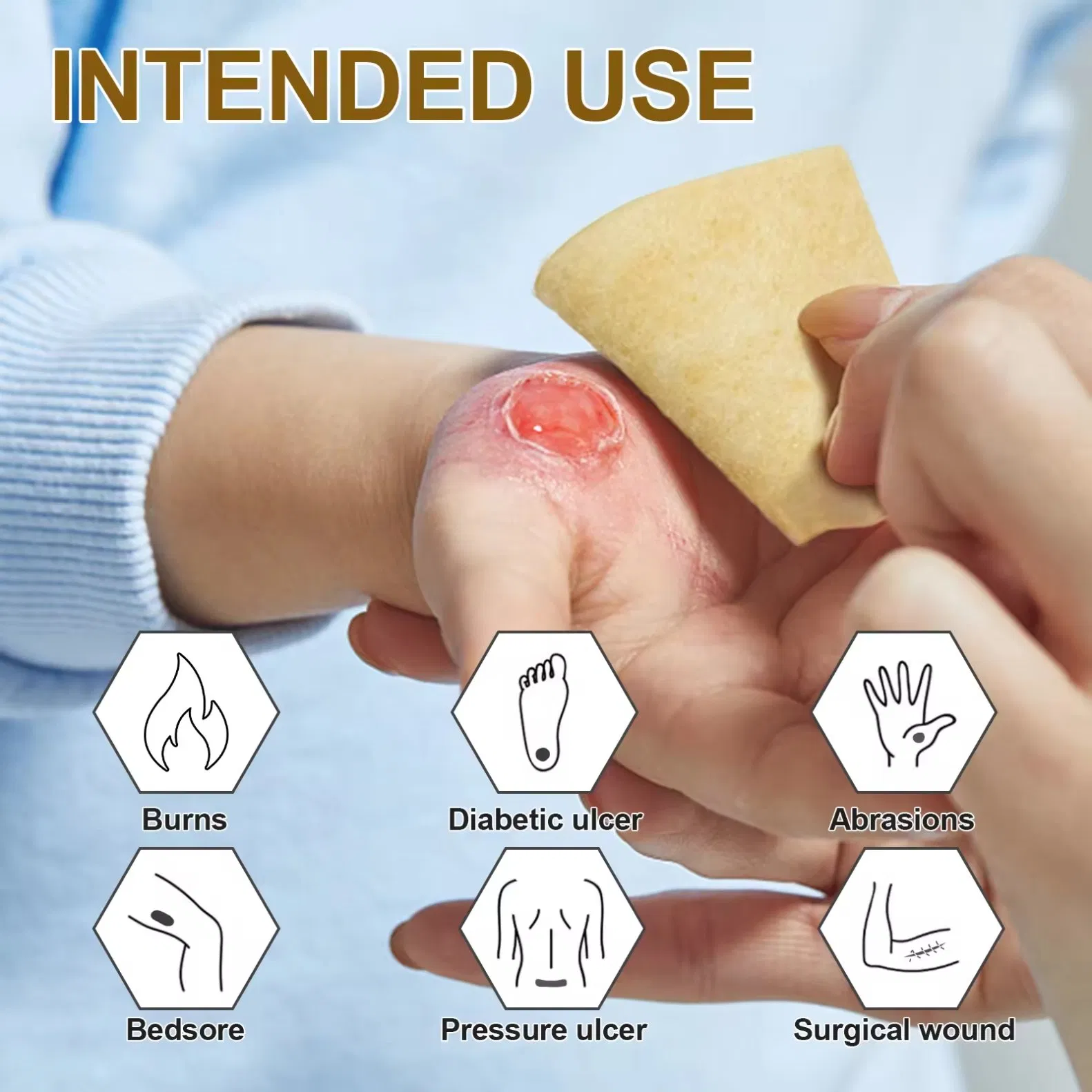 Antibacterial Soft Skin-Friendly Manuka Honey Calcium Alginate Wound Dressing for Wound Care