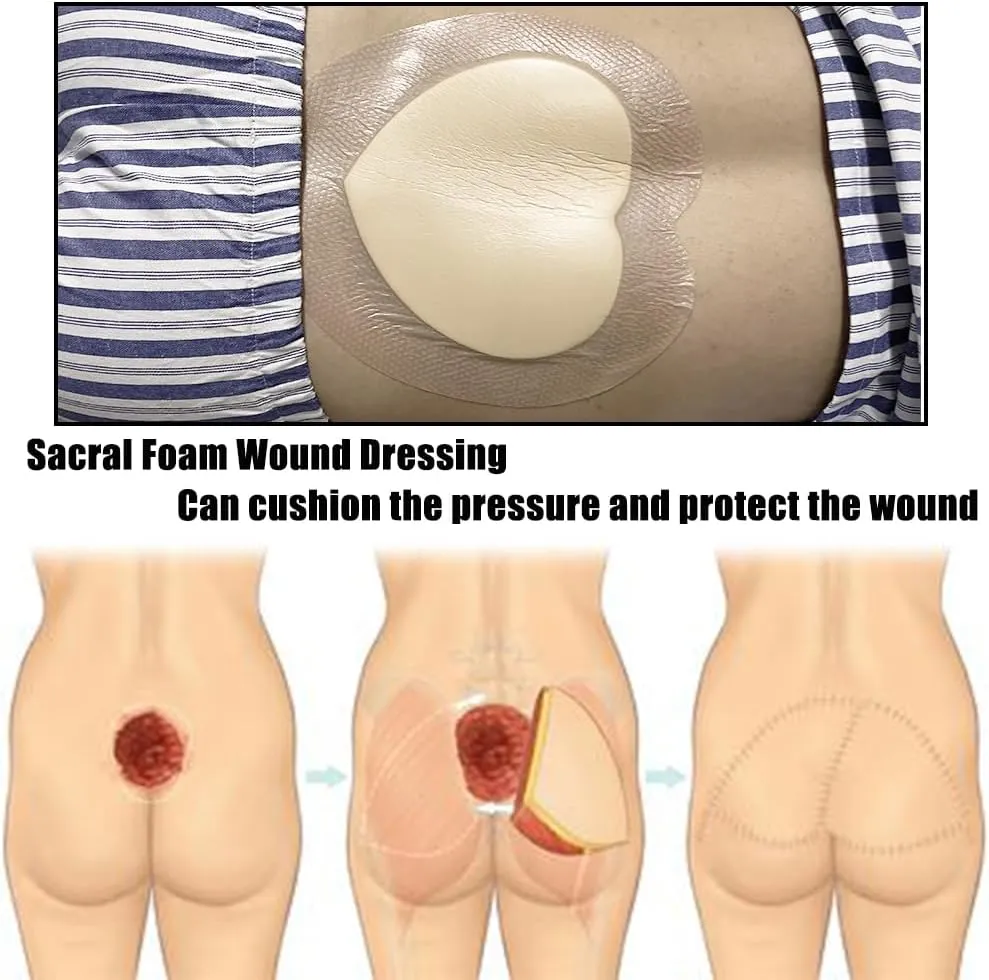 Silicone Gel Foam Dressing