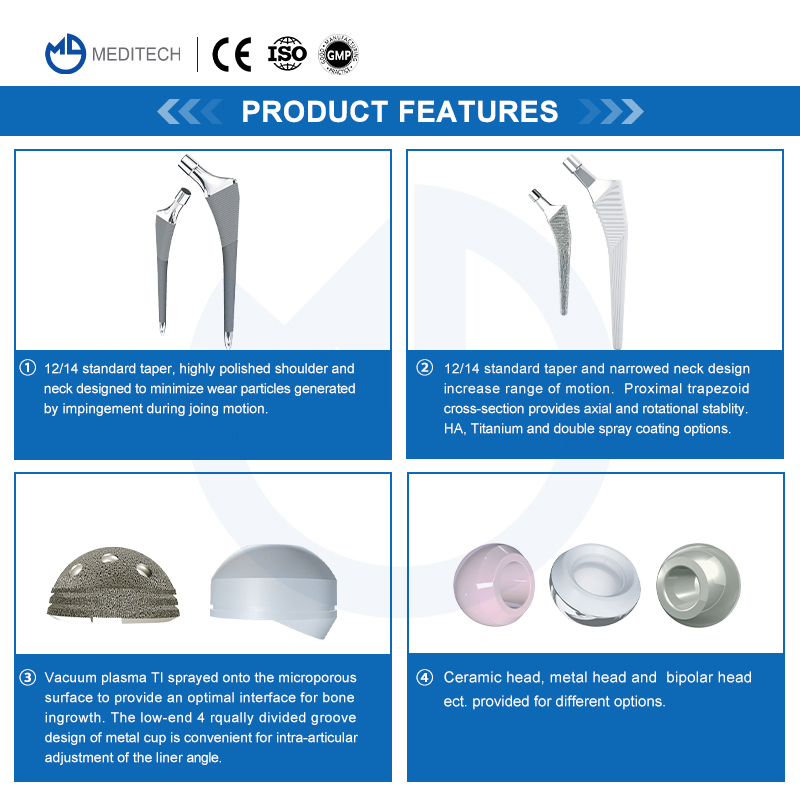 Orthopedic Implants Titanium Hip Prosthesis Replacement Devices Cementless Femoral Stem