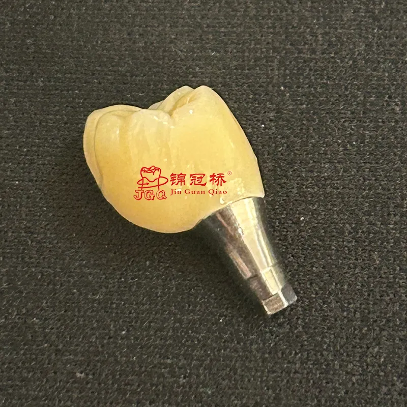 Custom Implant Crown