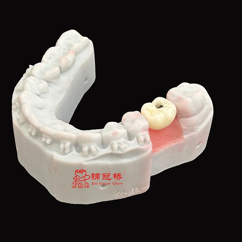 Dental Digital Titanium Implant Bar