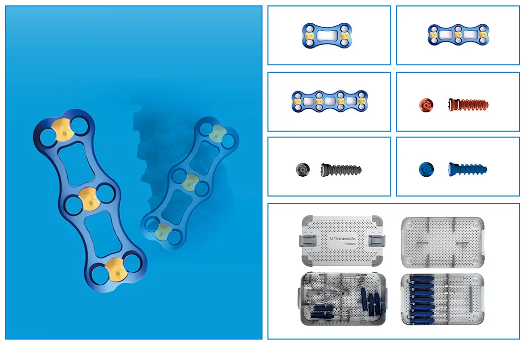 Anterior Cervical Plate Spine Internal Fixation