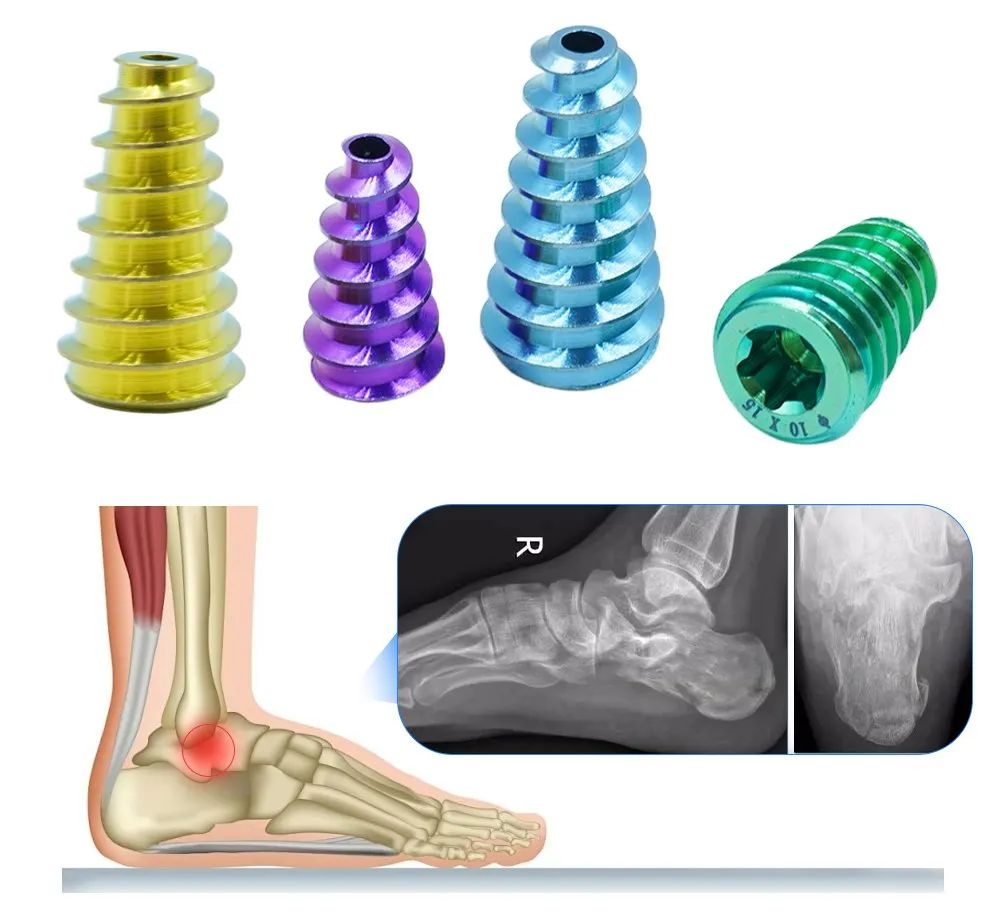 Incision and Reconstruction