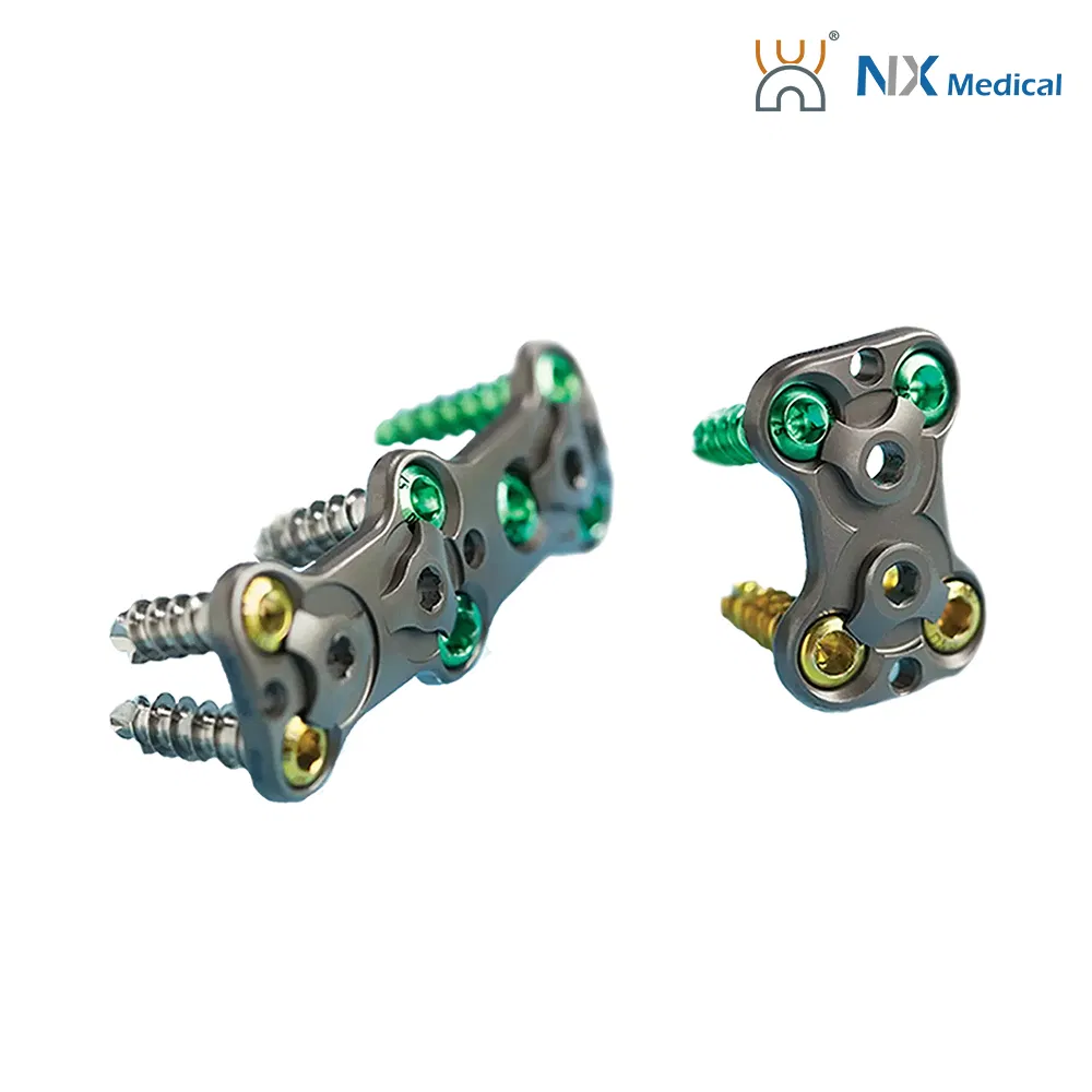 Nx Medical Premium Titanium Anterior Cervical Plate System Orthopedic Spine Implant