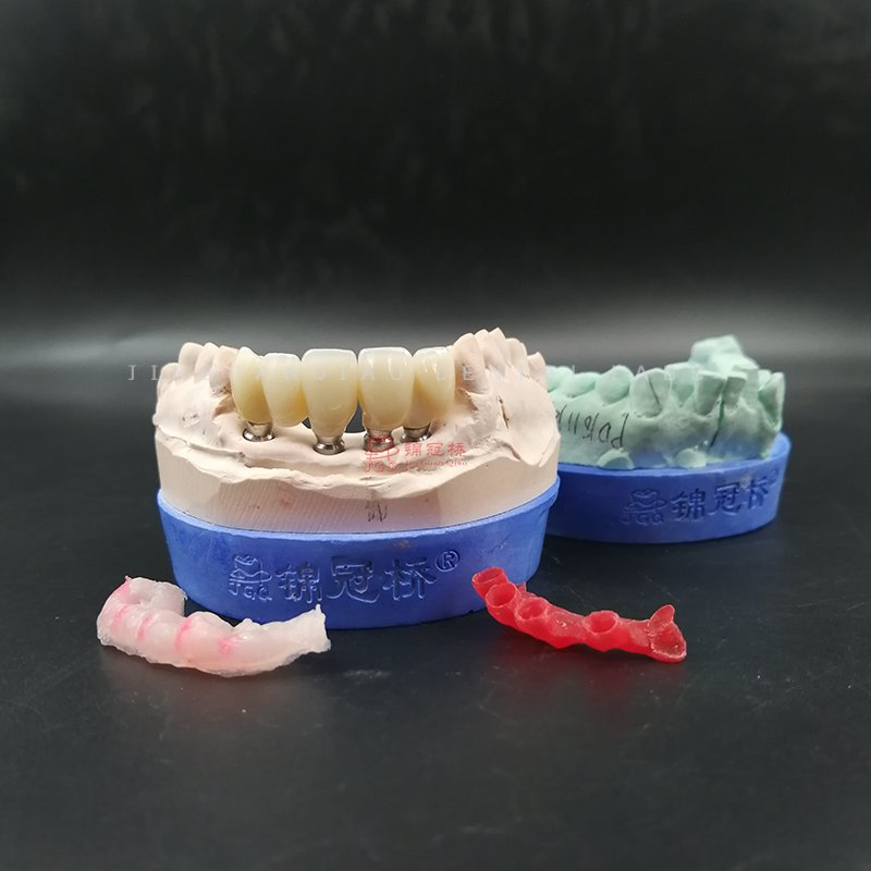 China Dental Lab Supply Dental Products Implant Dentures with Customized Titanium Abutment