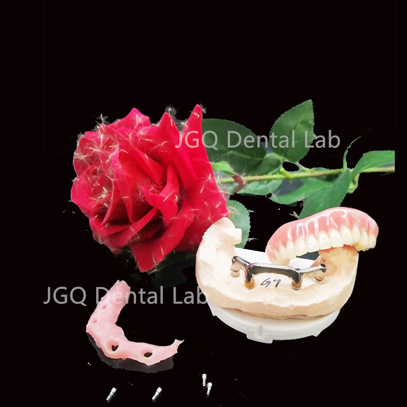 Full Service Implant Restorations Titanium Implant Bar Dental Lab with Stl Dcm Ply Case