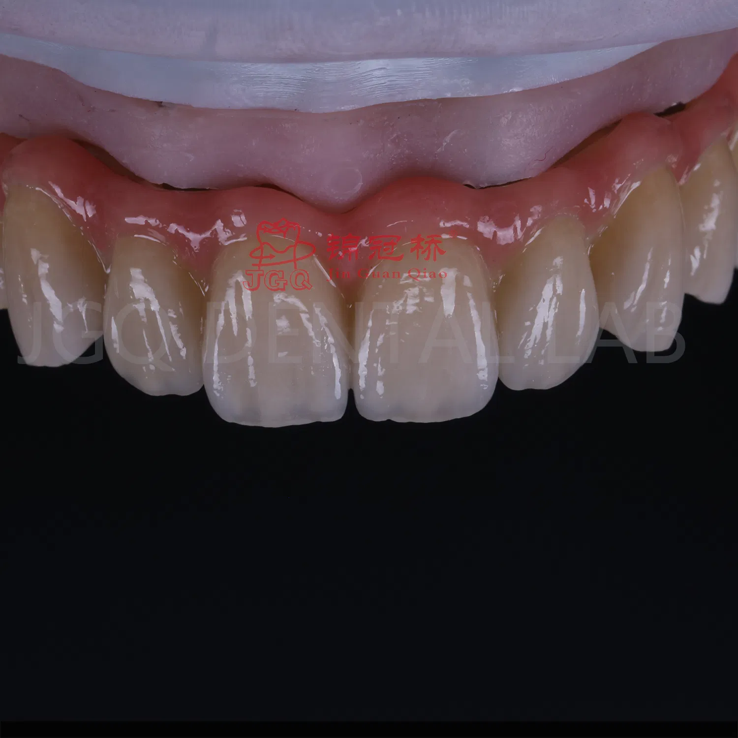 Dental Implant Hybrid Dentures with Titanium Bridge and Screwed Zircornia Crowns Lab China