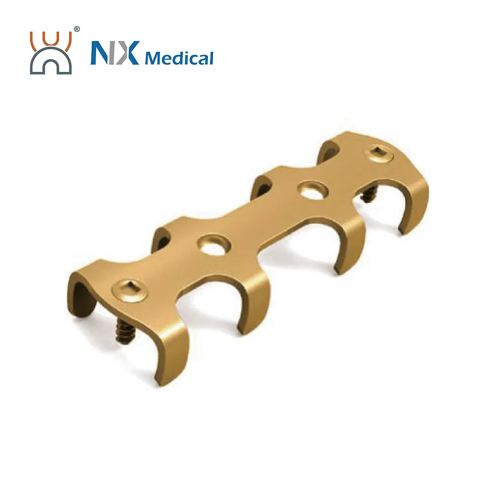 Nx Medical Titanium Locking Plate Rib 2.9mm System for Orthopedic Fixation