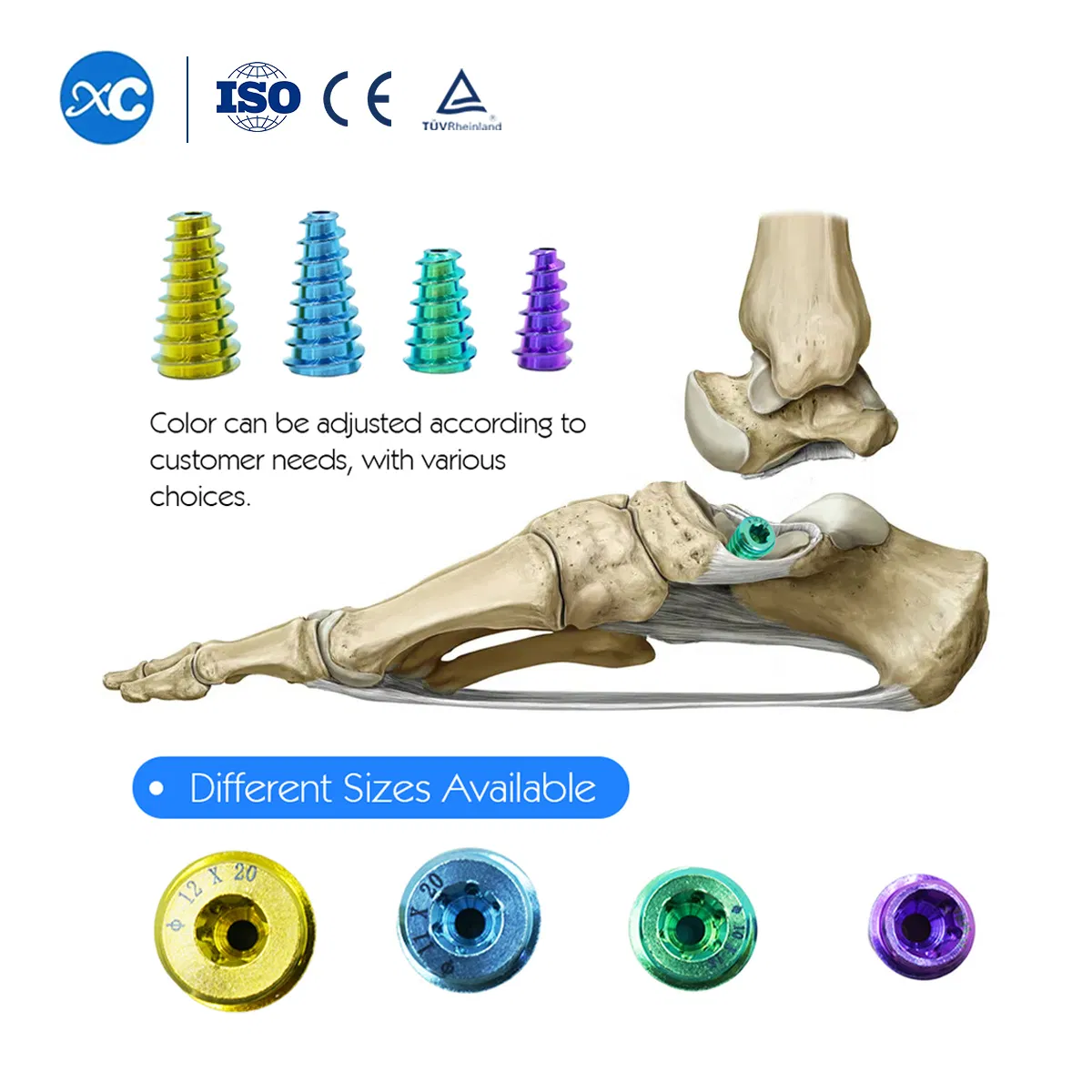Sinus Tarsal Screw for Foot and Ankle System Orthopedic Screw