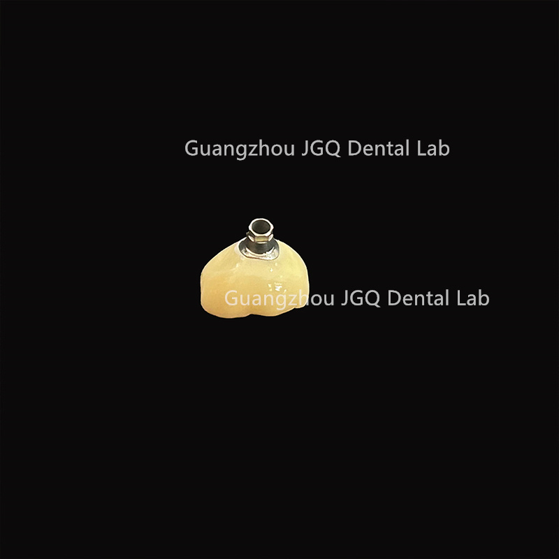 Dental Implant Zirconia Crown and Titanium Abutment Competitive Price Dental Lab Manufacture