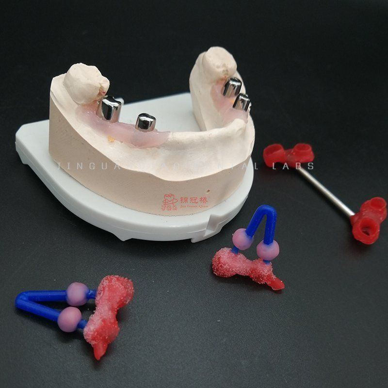 China Dental Lab Supply Dental Products Implant Dentures with Customized Titanium Abutment