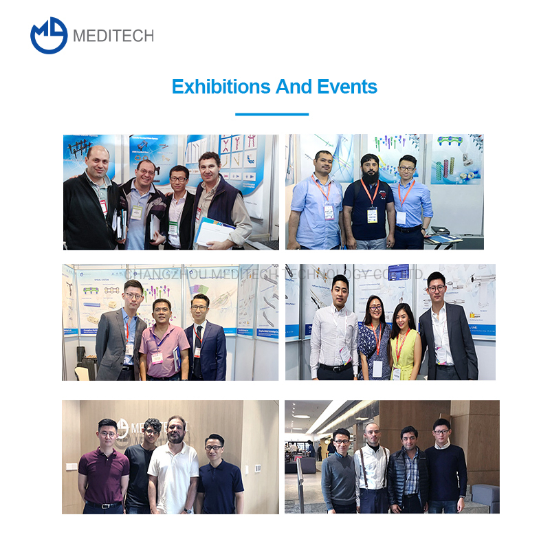 Orthopedic Implants Titanium Medical Bone Screws 2.0/3.5/4.5mm