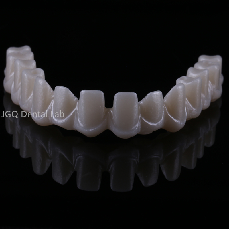 All on Dental Implants with Zircornia Abutment Dental Implant Titanium Bridges and Screwed Crowns