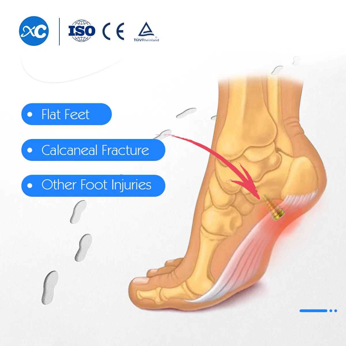 Sinus Tarsal Screw for Foot and Ankle System Orthopedic Screw