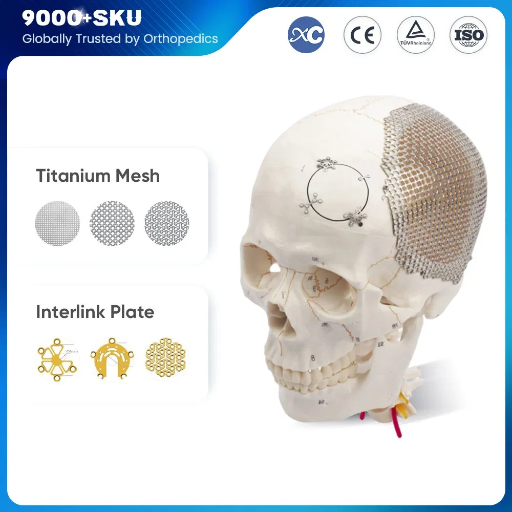 3D Flower Shape Titanium Neurosurgery Cranial Skull Maxillofacial Mesh